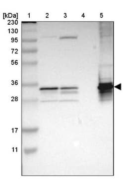 TST Antibody, Novus Biologicals:Antibodies:Primary Antibodies